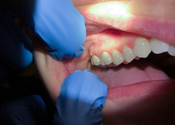 Best Mobile Emergency Dentist in Ferguson, MO