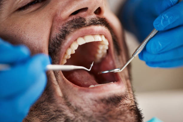 Best Mobile Emergency Dentist in Ferguson, MO